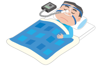 CPAP